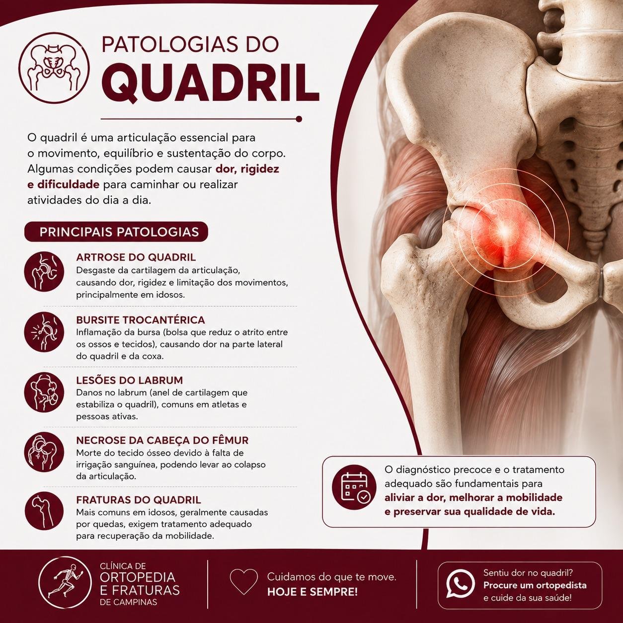 Quadril